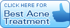 best acne treatment